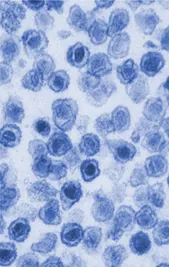 gammaretrovirus: any retrovirus of the genus Gammaretrovirus