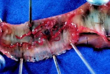 gapeworm: a parasitic nematode worm (Syngamus trachea), that infects the tracheas of some birds and causes...