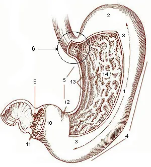 gastrectomy: a surgery in which part or all of the stomach is removed to treat conditions such as stomach...