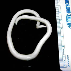 giant roundworm: a species of roundworm, Ascaris lumbricoides, the largest and most common parasitic worm in humans,...