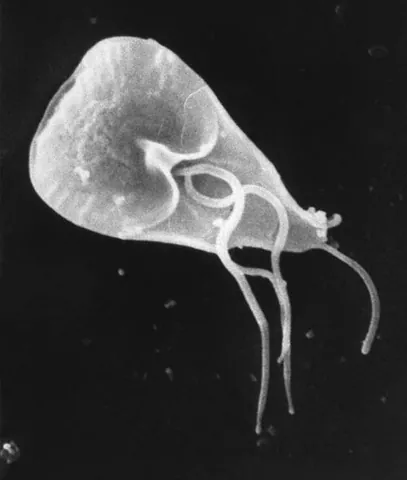 giardia: the human intestinal parasite Giardia lamblia