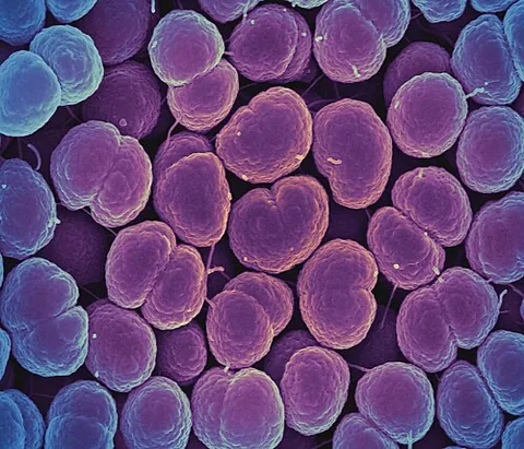 gonococcus: any of the bacteria (Neisseria gonorrhoeae) that are responsible for gonorrhea