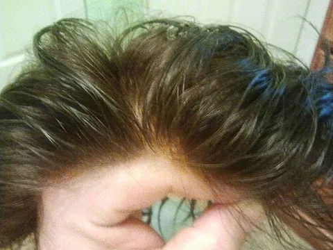 hair system: a modern custom hair replacement solution that blends in seamlessly, made of real human hair on a...