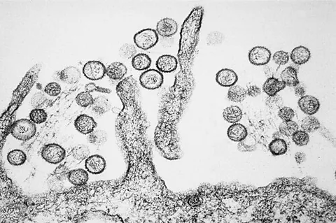 hantavirus: any virus of the genus Hantavirus, transmitted by aerosolized rodent excreta or rodent bites,...