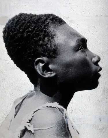 head binding: the intentional deformation of a living person's skull by binding it with cloth or wood,...