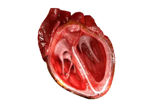 heart valve: any of the valves in the heart which prevent blood from moving in the wrong direction