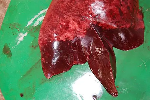 hepatization: the conversion into a substance resembling the liver; a state of the lungs when gorged with effused...