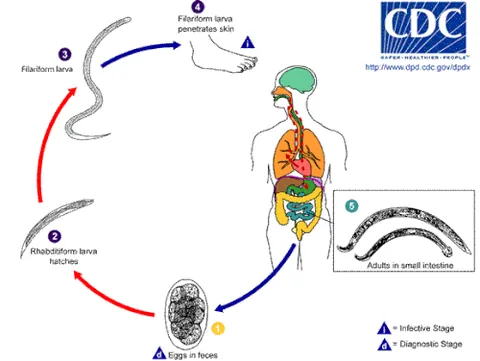 hookworm: any of various parasitic bloodsucking roundworms which cause disease, especially the species...