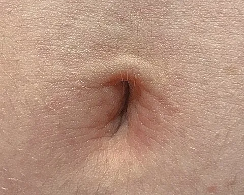 innie: a navel that is formed of a hollow in the abdomen (as opposed to one that protrudes from the...