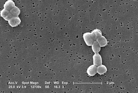 iraqibacter: synonym of Acinetobacter baumannii