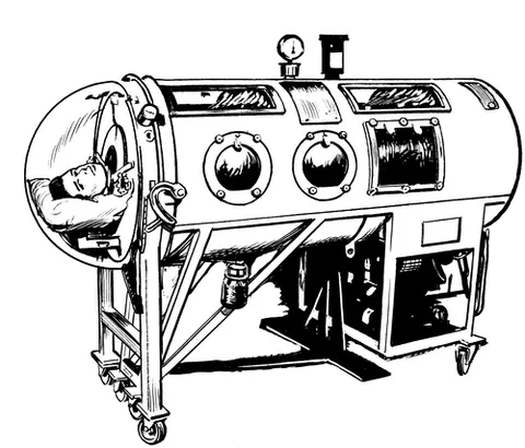 iron lung: a pneumonic device for assisted breathing