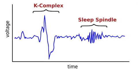 k-complex: a waveform that occurs approximately every 60–100 seconds during stage 2 of NREM sleep, and which...