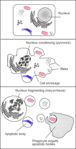 karyorrhexis: the destructive fragmentation of the nucleus of a dying cell whereby its chromatin is distributed...