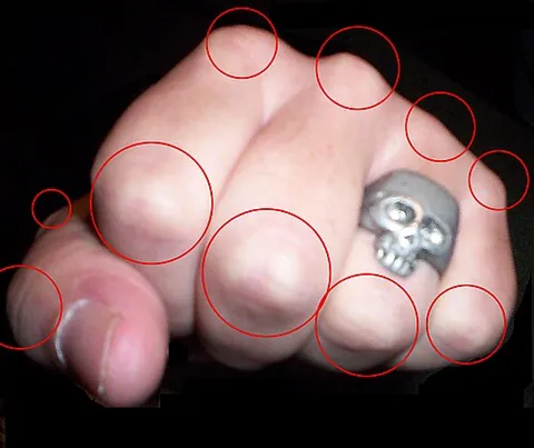 knuckle: any of the joints between the bones of the fingers