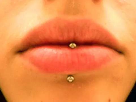 labret: a body piercing consisting of an adornment attached to the lip