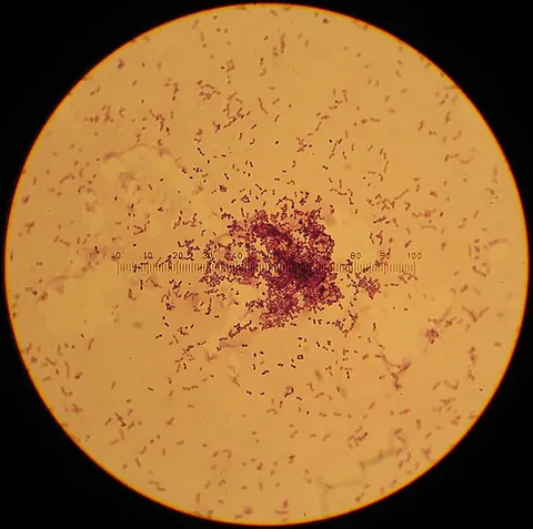 lactococcus: any bacterium of the genus Lactococcus