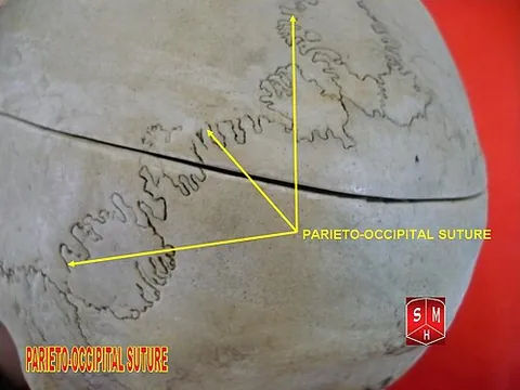 lambdoid: shaped like the Greek letter lambda