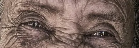 laughter lines: wrinkles at the outer corners of the eye
