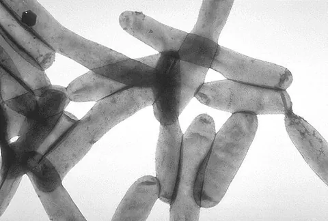 legionella: bacteria of the genus Legionella