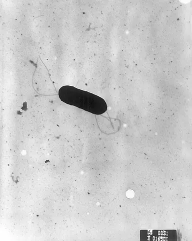 listeria: any rod-shaped, gram-positive bacterium, of the genus Listeria, especially those responsible for...