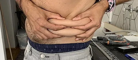 love handle: a protruding area of fat on the side of the body, above the hips