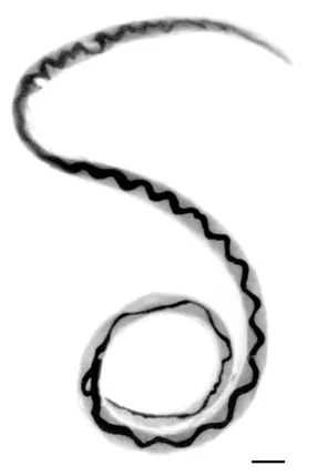 lungworm: any of the diverse species of nematode worms that are parasitic to mammalian lungs, principally...