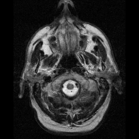 magnetic resonance imaging: a technique that uses nuclear magnetic resonance to form cross sectional images of the human body...