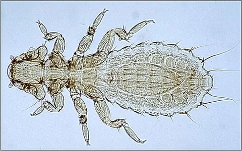 mallophagan: a chewing louse, any louse of the now obsolete suborder Mallophaga, any true louse that is not a...