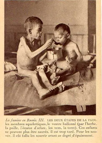 malnutrition: a lack of adequate nourishment