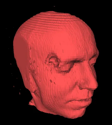 marching cubes: an algorithm for extracting a polygonal mesh of an isosurface from a three-dimensional scalar field