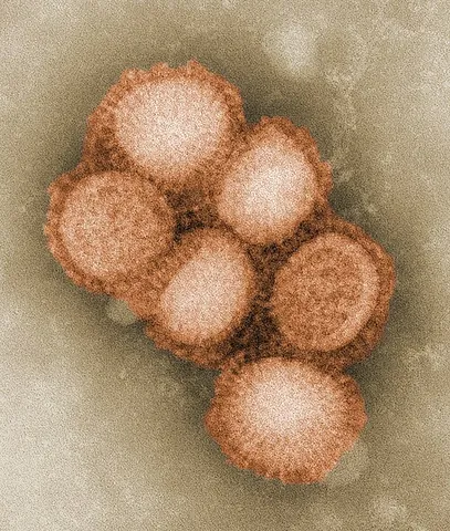 mexican influenza: the virus pandemic H1N1/09 virus