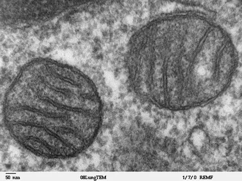 mitochondrion: a spherical or ovoid organelle found in the cytoplasm of eukaryotic cells and containing genetic...