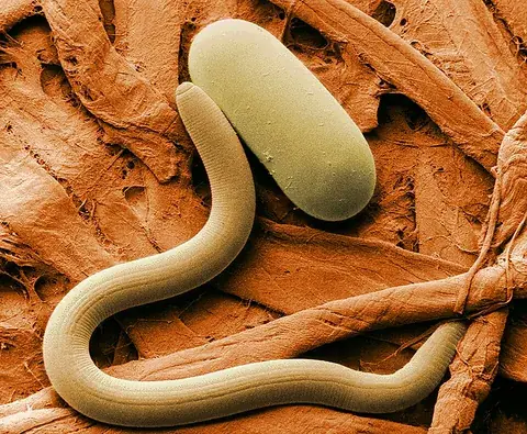 nematode: a worm of the large phylum Nematoda, such as a roundworm or threadworm