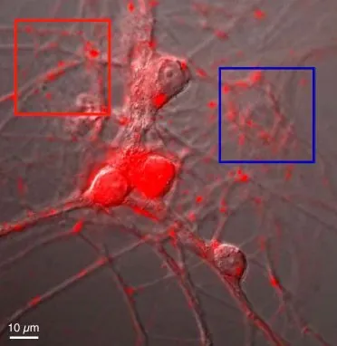 neuron: a cell of the nervous system, which conducts nerve impulses; consisting of an axon and several...