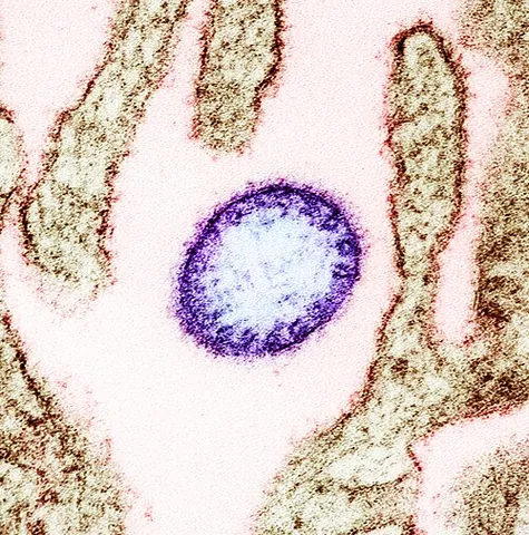nipah virus: nipah henipavirus, a bat-borne virus that can infect humans and other animals