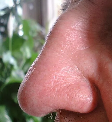 nose: a protuberance on the face housing the nostrils, which are used to breathe or smell