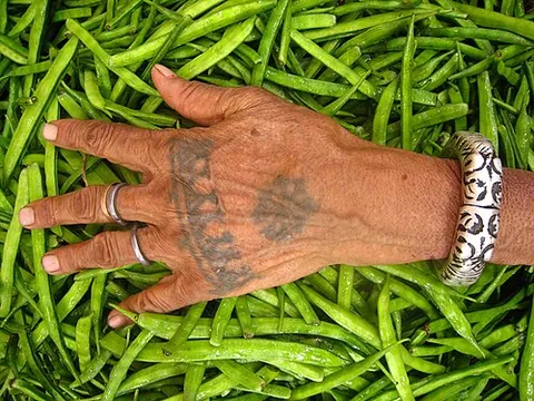 opisthenar: the back of the hand