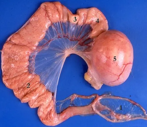 oviduct: a duct through which an ovum passes from an ovary to the uterus or to the exterior