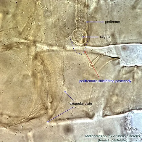 peritreme: that part of the integument of an insect surrounding the spiracles