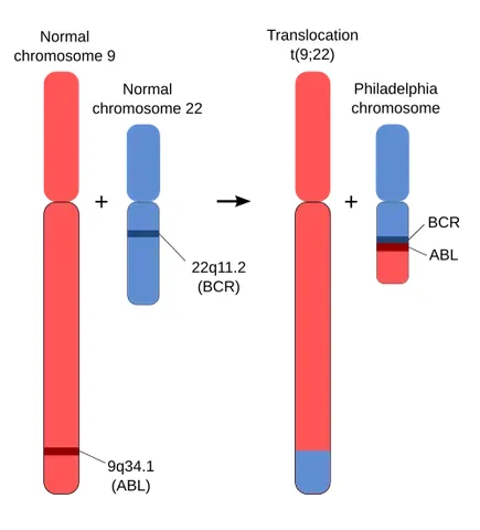 philadelphia chromosome: human chromosome 22, after it has, pathologically, traded some of its genetic material with...