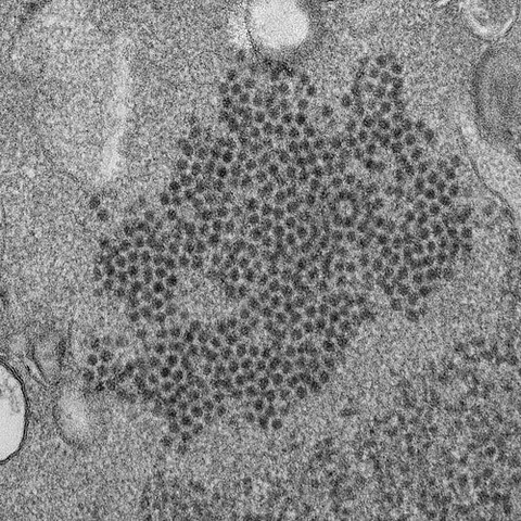 picornavirus: any of the family Picornaviridae of RNA viruses, many of which are pathogenic, causing diseases...