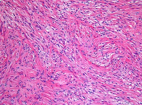 pilocyte: any cell with prominent external hair-like structures