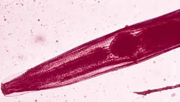 pinworm: any of several nematode worms, of the family Oxyuridae, that are parasitic to mammals