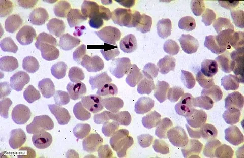 piroplasma: babesia, a genus of hematozoa that invades the red blood cells of humans and domesticated animals...