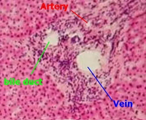 portal triad: a distinctive component of a hepatic lobule, found running along each of the lobule's corners, that...