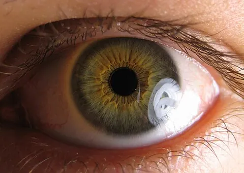 purkinje image: any of various reflections of objects within the structure of the eye