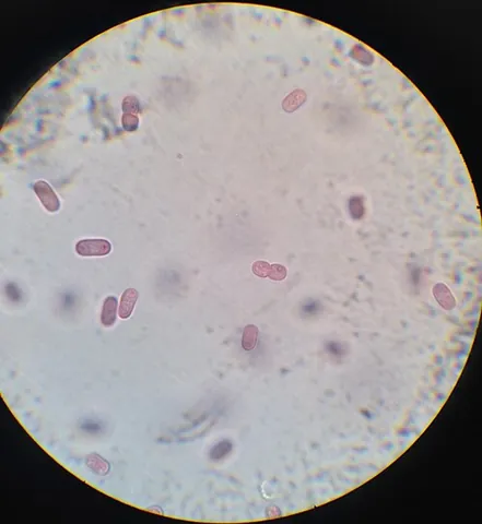 purple bacteria: proteobacteria that produce their own food using photosynthesis, with colors including purple, red,...
