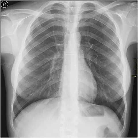 radiograph: an image, often a photographic negative, produced by radiation other than visible light; especially...