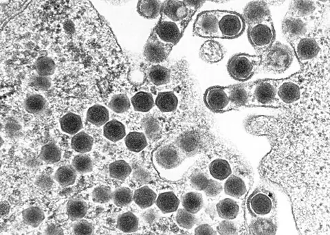 ranavirus: any virus of the genus Ranavirus, many of which cause disease in amphibians