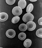 red blood cell: a type of cell in the blood of vertebrates that contains hemoglobin and transports oxygen from the...